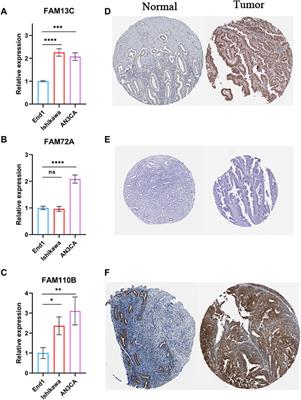 FAM family gene prediction model reveals heterogeneity, stemness and immune microenvironment of UCEC